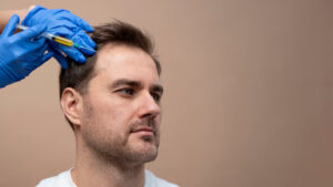 Hair Transplants and Mental Health: A Closer Look at the Connection
