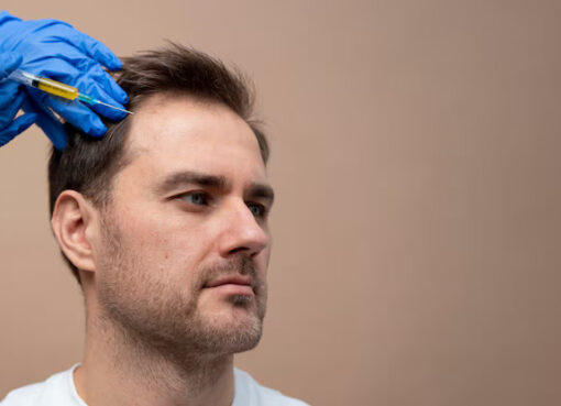 Hair Transplants and Mental Health