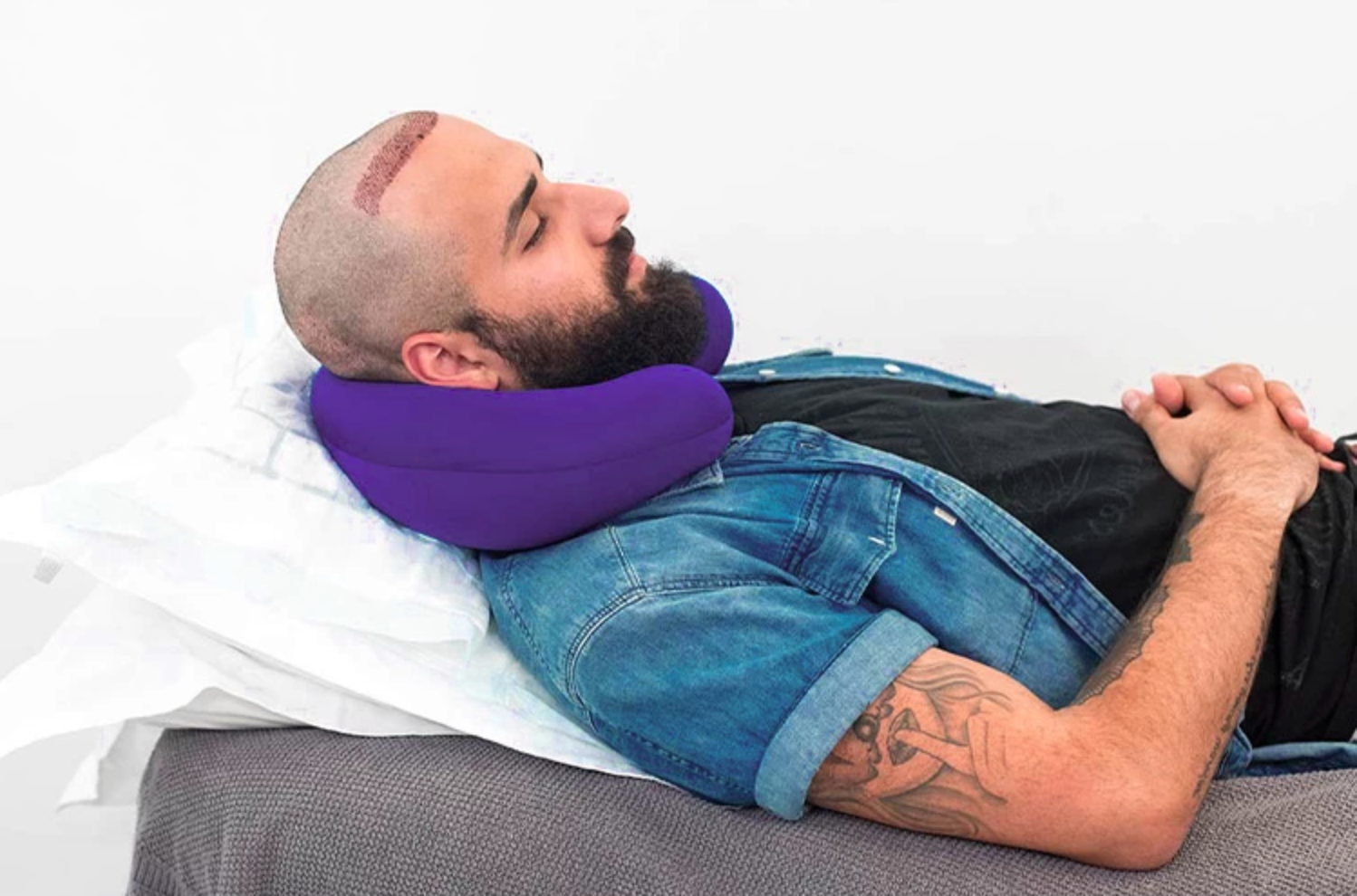 How to Sleep After a Hair Transplant Without Damaging the Grafts